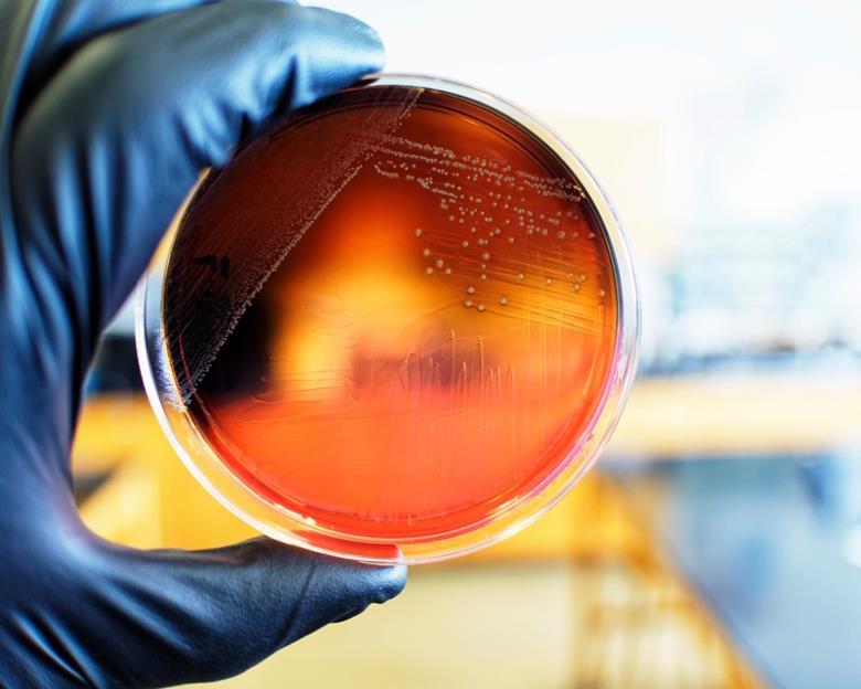 Unpacking the evolving science of pathogen persistence in food ...